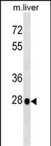 Rabbit Polyclonal Antibody to Mouse Hoxb5 (N-term)
