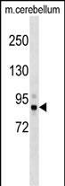 Rabbit Polyclonal Antibody to Mouse Tbk1 (N-term)