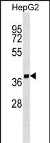 Rabbit Polyclonal Antibody to SCAMP2