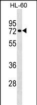 Rabbit Polyclonal Antibody to RHOT2