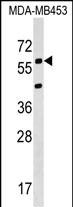 Rabbit Polyclonal Antibody to KCNS3 (N-term)