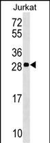 Rabbit Polyclonal Antibody to ANP32C