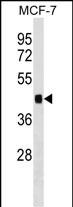 Rabbit Polyclonal Antibody to IER5