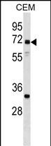 Rabbit Polyclonal Antibody to NPLOC4