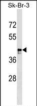 Rabbit Polyclonal Antibody to MARCH9
