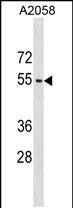 Rabbit Polyclonal Antibody to ACTL9 (N-term)