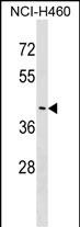 Rabbit Polyclonal Antibody to FEZ2 (N-term)