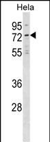 Rabbit Polyclonal Antibody to NET1