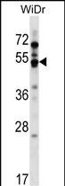 Rabbit Polyclonal Antibody to GPR84