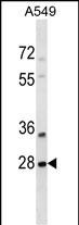 Rabbit Polyclonal Antibody to SNF8 (N-term)