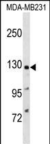 Rabbit Polyclonal Antibody to PPFIA1 (N-term)