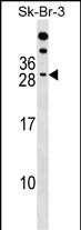 Rabbit Polyclonal Antibody to RAP2B