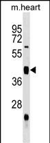 Rabbit Polyclonal Antibody to Mouse Uhmk1 (N-term)