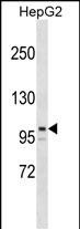 Rabbit Polyclonal Antibody to ARID5B
