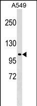 Rabbit Polyclonal Antibody to HECTD3