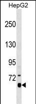 Rabbit Polyclonal Antibody to SLC27A1