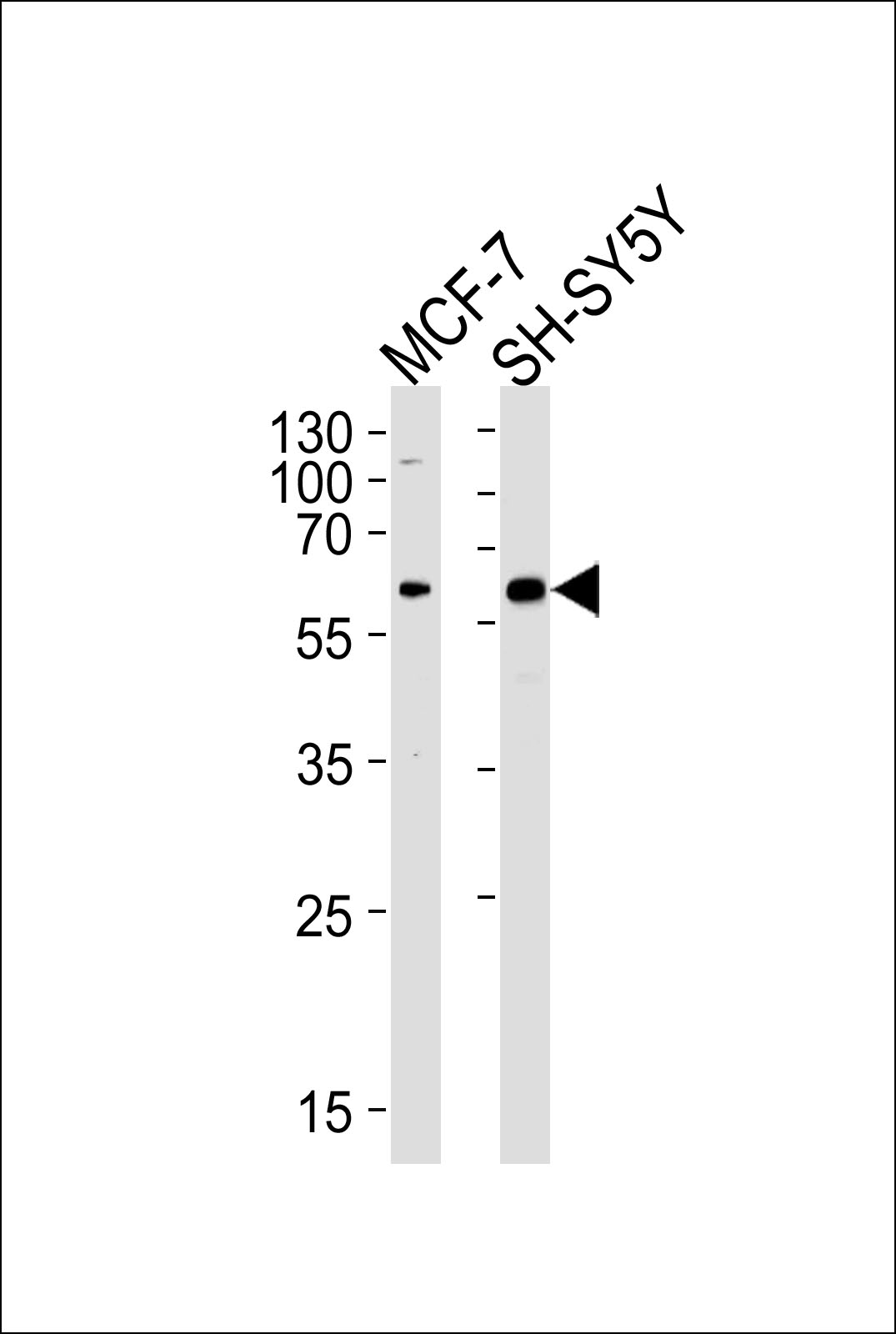 Rabbit Polyclonal Antibody to ZBTB22