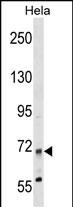 Rabbit Polyclonal Antibody to MTMR14 (N-term)