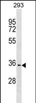 Rabbit Polyclonal Antibody to PBLD