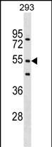 Rabbit Polyclonal Antibody to FBXW9 (N-term)