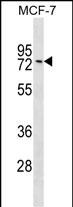 Rabbit Polyclonal Antibody to GNL1
