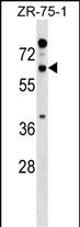 Rabbit Polyclonal Antibody to RTN2 (N-term)