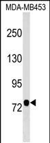 Rabbit Polyclonal Antibody to AOPEP (N-term)