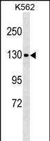Rabbit Polyclonal Antibody to CHERP