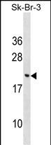 Rabbit Polyclonal Antibody to CNIH3 (N-term)
