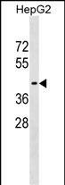 Rabbit Polyclonal Antibody to WIPI1
