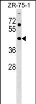 Rabbit Polyclonal Antibody to ZNF323