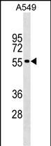 Rabbit Polyclonal Antibody to GLDN