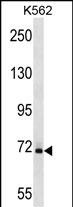 Rabbit Polyclonal Antibody to SAMHD1