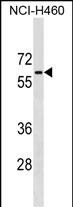 Rabbit Polyclonal Antibody to PGM5