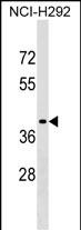 Rabbit Polyclonal Antibody to SNX21