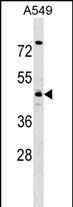 Rabbit Polyclonal Antibody to TMOD4