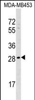 Rabbit Polyclonal Antibody to AIDA