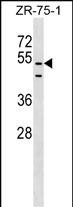 Rabbit Polyclonal Antibody to PDZD3