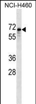 Rabbit Polyclonal Antibody to SNTB1