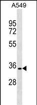Rabbit Polyclonal Antibody to PACRG (N-term)