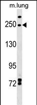 Rabbit Polyclonal Antibody to INF2