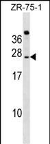 Rabbit Polyclonal Antibody to IGSF6