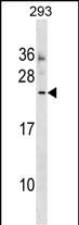 Rabbit Polyclonal Antibody to MOSPD3