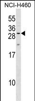 Rabbit Polyclonal Antibody to MPZL2