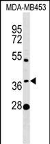 Rabbit Polyclonal Antibody to MTHFSD (N-term)