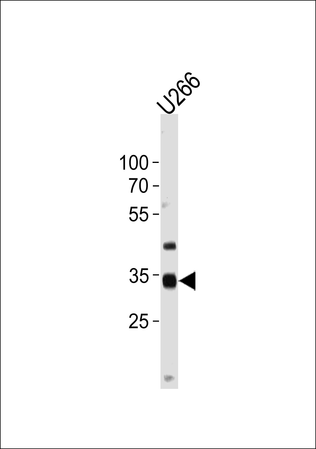 Rabbit Polyclonal Antibody to NKX3-2