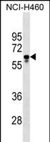 Rabbit Polyclonal Antibody to PGS1