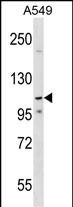 Rabbit Polyclonal Antibody to PHF20L1