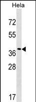 Rabbit Polyclonal Antibody to VPS37C