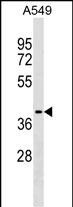Rabbit Polyclonal Antibody to ZCCHC12